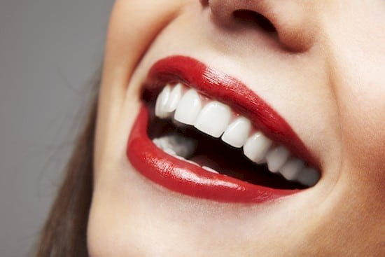 Pros and Cons of Dental Veneers