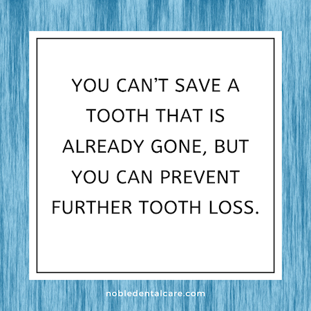 You can’t save a tooth that is already gone, but you can prevent further tooth loss