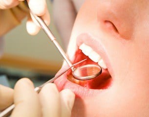 Practical Ways to Maintaining Healthy Gums
