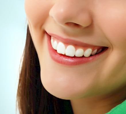 Woman smiling with white teeth.