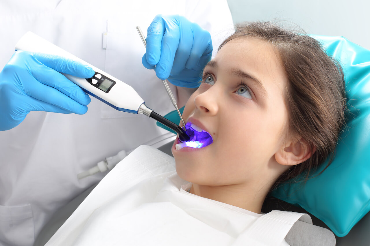Applying special curing light to harden the tooth sealant.