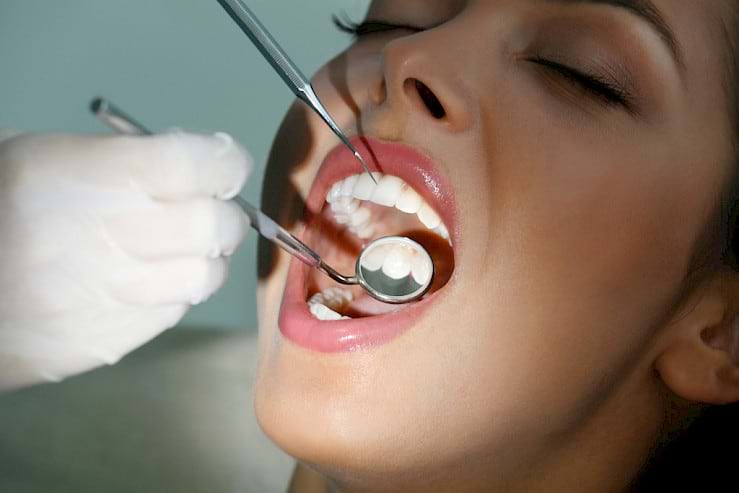 Comprehensive full mouth debridement cleaning by dentist.