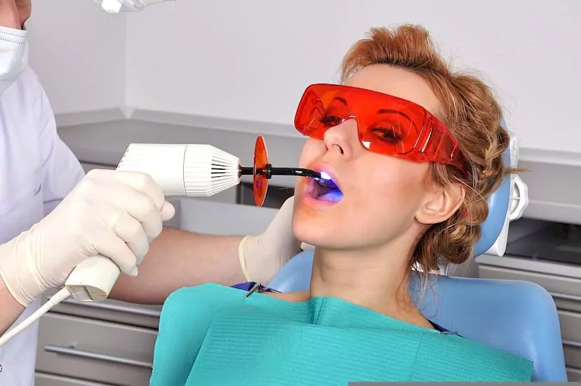 dental-fillings-post